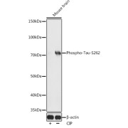 Western blot analysis of lysates from Mouse brain, using Phospho-Tau-S262 Antibody at 1/500 dilution. Mouse brain were treated by CIP(20uL/400ul) at 37 °C for 1 hour. Secondary antibody: HRP-conjugated Goat anti-Rabbit IgG (H+L) at 1/10000 dilution. Lysates/proteins: 25 µg per lane. Blocking buffer: 3% nonfat dry milk in TBST. Exposure time: 120s.