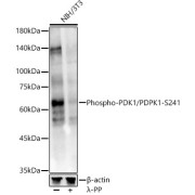 Western blot analysis of lysates from NIH/3T3 cells, using Phospho-PDK1/PDPK1-S241 Antibody at 1/1000 dilution. NIH/3T3 cells were treated by λ-PP mixed solution (1ul) at 30 °C for 30 minutes. Secondary antibody: HRP-conjugated Goat anti-Rabbit IgG (H+L) at 1/10000 dilution. Lysates/proteins: 25 µg per lane. Blocking buffer: 3% nonfat dry milk in TBST. Exposure time: 30s.