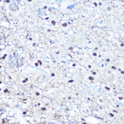 Retinoblastoma Protein 1 Phospho-Ser780 (RB1 pS780) Antibody