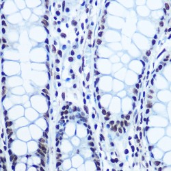 Retinoblastoma Protein 1 Phospho-Ser780 (RB1 pS780) Antibody