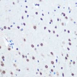 Retinoblastoma Protein 1 Phospho-Ser780 (RB1 pS780) Antibody