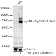 Western blot analysis of lysates from HeLa cells, using Phospho-NF-kB p65/RelA-S468 Antibody at 1/400 dilution. HeLa cells were treated by TNF-α (20 ng/ml) and Calyculin A (100 nM) at 37 °C for 30 minutes after serum-starvation overnight. Secondary antibody: HRP-conjugated Goat anti-Rabbit IgG (H+L) at 1/10000 dilution. Lysates/proteins: 25 µg per lane. Blocking buffer: 3% nonfat dry milk in TBST. Exposure time: 60s.