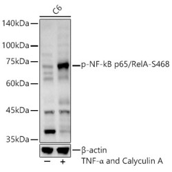 RELA (pS468) Antibody