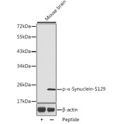 Western blot analysis of lysates from mouse brain tissue, using Phospho-α-Synuclein-S129 Antibody. Secondary antibody: HRP-conjugated Goat anti-Rabbit IgG (H+L) at 1/10000 dilution. Lysates/proteins: 25 µg per lane. Blocking buffer: 3% BSA.