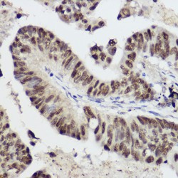 Signal Transducer And Activator of Transcription 1 (STAT1) Antibody