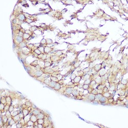 Phosphatidylinositol-3,4,5-Trisphosphate 5-Phosphatase 1 (INPP5D) Antibody