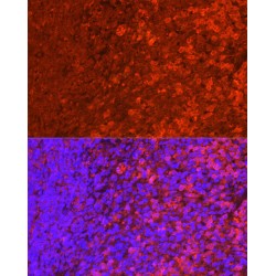 Phosphatidylinositol-3,4,5-Trisphosphate 5-Phosphatase 1 (INPP5D) Antibody