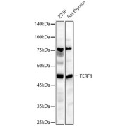 Western blot analysis of various lysates, using TERF1 Antibody at 1/2000 dilution. Secondary antibody: HRP-conjugated Goat anti-Rabbit IgG (H+L) at 1/10000 dilution. Lysates/proteins: 25 µg per lane. Blocking buffer: 3% nonfat dry milk in TBST. Exposure time: 180s.