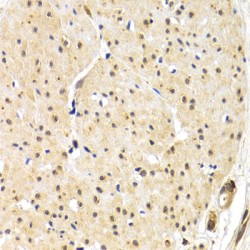 Telomeric Repeat-Binding Factor 1 (TERF1) Antibody