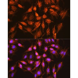 Bcl-2-Like Protein 1 (BCL2L1) Antibody