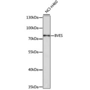 Western blot analysis of lysates from NCI-H460 cells, using BVES Antibody at 1/1000 dilution. Secondary antibody: HRP-conjugated Goat anti-Rabbit IgG (H+L) at 1/10000 dilution. Lysates/proteins: 25 µg per lane. Blocking buffer: 3% nonfat dry milk in TBST. Exposure time: 45s.