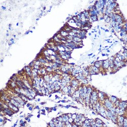 Docking Protein 4 (DOK4) Antibody