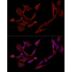 Docking Protein 4 (DOK4) Antibody