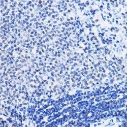 Histone Deacetylase 1 (HDAC1) Antibody