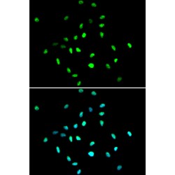 Histone Deacetylase 1 (HDAC1) Antibody