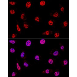 Histone Deacetylase 1 (HDAC1) Antibody