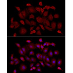 Insulin Receptor Substrate 1 (IRS1) Antibody