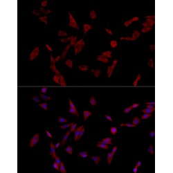 Insulin Receptor Substrate 1 (IRS1) Antibody