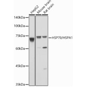 Western blot analysis of various lysates using HSP70 Antibody at 1/1000 dilution. Secondary antibody: HRP-conjugated Goat anti-Rabbit IgG (H+L) at 1/10000 dilution. Lysates / proteins: 25 µg per lane. Blocking buffer: 3 % nonfat dry milk in TBST. Detection: ECL Basic Kit (RM00020). Exposure time: 1s.