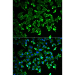 Heat Shock 70 kDa Protein 1A (HSPA1A) Antibody