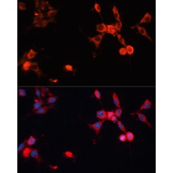 Heat Shock 70 kDa Protein 1A (HSPA1A) Antibody