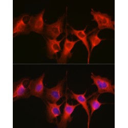 Heat Shock 70 kDa Protein 1A (HSPA1A) Antibody