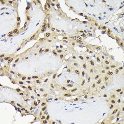 Mitogen-Activated Protein Kinase 8 / JNK1 (MAPK8) Antibody