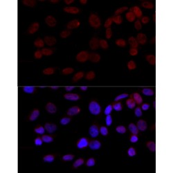 Mitogen-Activated Protein Kinase 8 / JNK1 (MAPK8) Antibody