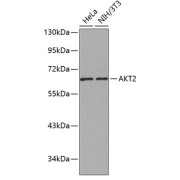 Western blot analysis of various lysates using AKT2 Antibody. Secondary antibody: HRP-conjugated Goat anti-Rabbit IgG (H+L) at 1/10000 dilution. Lysates/proteins: 25 µg per lane. Blocking buffer: 3% nonfat dry milk in TBST.