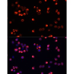 RAC-Beta Serine/threonine-Protein Kinase (AKT2) Antibody