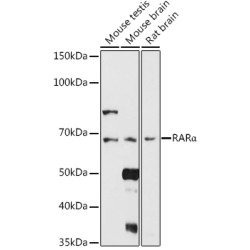 Retinoic Acid Receptor Alpha (RARA) Antibody