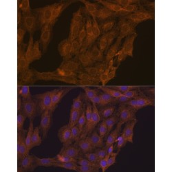 Retinoic Acid Receptor Alpha (RARA) Antibody