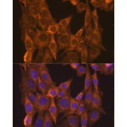 Retinoic Acid Receptor Alpha (RARA) Antibody