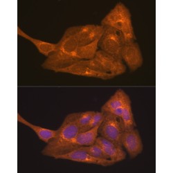 Retinoic Acid Receptor Alpha (RARA) Antibody