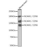 Western blot analysis of lysates from mouse brain, using NCAM1 / CD56 Antibody. Secondary antibody: HRP-conjugated Goat anti-Rabbit IgG (H+L) at 1/10000 dilution. Lysates/proteins: 25 µg per lane. Blocking buffer: 3% nonfat dry milk in TBST.