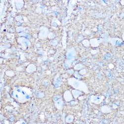 Neural Cell Adhesion Molecule 1 / CD56 (NCAM1) Antibody