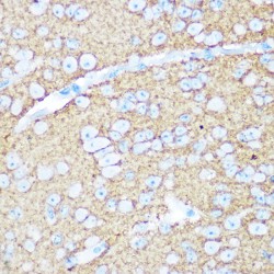 Neural Cell Adhesion Molecule 1 / CD56 (NCAM1) Antibody