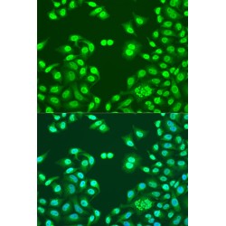 Nuclear Mitotic Apparatus Protein 1 (NUMA1) Antibody