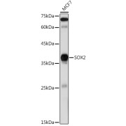 Western blot analysis of lysates from MCF7 cells, using SOX2 Antibody at 1/1000 dilution. Secondary antibody: HRP-conjugated Goat anti-Rabbit IgG (H+L) at 1/10000 dilution. Lysates/proteins: 25 µg per lane. Blocking buffer: 3% nonfat dry milk in TBST. Exposure time: 60s.