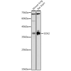 Transcription Factor SOX-2 (SOX2) Antibody