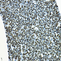 Transcription Factor SOX-2 (SOX2) Antibody