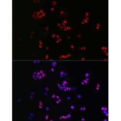 Transcription Factor SOX-2 (SOX2) Antibody