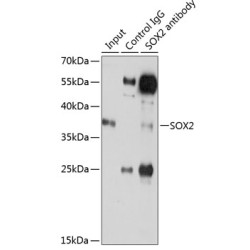 Transcription Factor SOX-2 (SOX2) Antibody