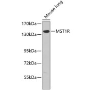 Western blot analysis of lysates from mouse lung, using MST1R Antibody. Secondary antibody: HRP-conjugated Goat anti-Rabbit IgG (H+L) at 1/10000 dilution. Lysates/proteins: 25 µg per lane. Blocking buffer: 3% nonfat dry milk in TBST.