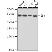 Western blot analysis of various lysates using SSB Antibody at 1/1000 dilution. Secondary antibody: HRP-conjugated Goat anti-Rabbit IgG (H+L) at 1/10000 dilution. Lysates/proteins: 25 µg per lane. Blocking buffer: 3% nonfat dry milk in TBST. Exposure time: 1s.