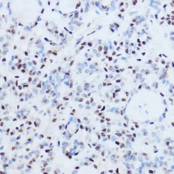 Lupus La Protein (SSB) Antibody