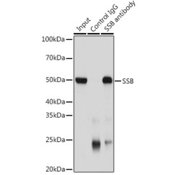 Lupus La Protein (SSB) Antibody