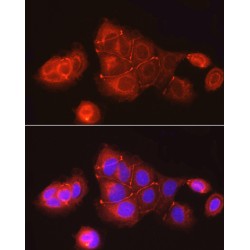 Tight Junction Protein ZO-1 (TJP1) Antibody