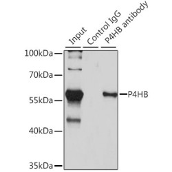 Protein Disulfide-Isomerase / PDI (P4HB) Antibody