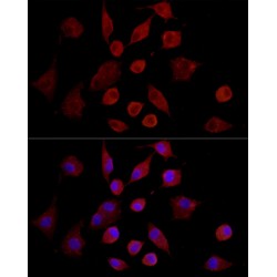 Matrix Metalloproteinase-7 (MMP7) Antibody